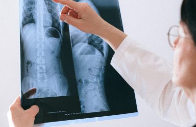 sv dan protiv tuberkuloze